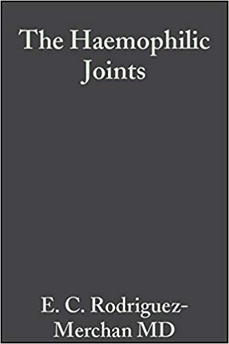 کتاب زبان د هموفیلیک جوینتس The Haemophilic Joints New Perspectives