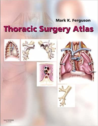 کتاب توراسیک سرجری اطلس Thoracic Surgery Atlas