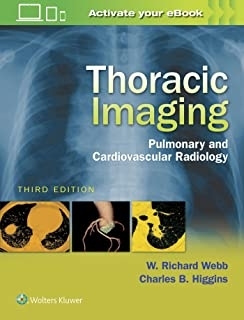 کتاب توراسیک ایمیجینگ Thoracic Imaging Pulmonary and Cardiovascular Radiology