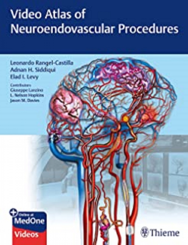 کتاب ویدئو اطلس آف نیورواندوواسکولار پروسیجرز&nbsp;Video Atlas of Neuroendovascular Procedures 1st Edition2020
